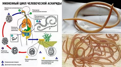 Ascaris при деца (34 снимки): симптоми и лечение, лечение на аскаридоза ...