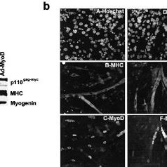 Rescue Of Myogenic Differentiation By Exogenous MyoD In QM Myc