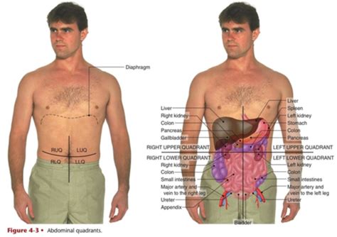 Approach To Patient With Abdominal Pain Flashcards Quizlet