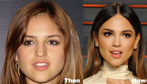 Eiza Gonzalez Plastic Surgery Before And After Photos 38955 The Best