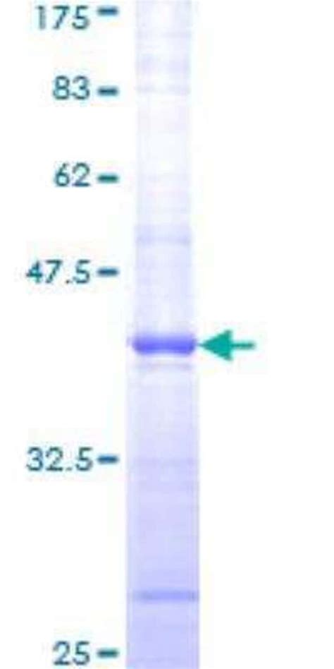 Novus Biologicals Recombinant Human Atm Gst N Term Protein G