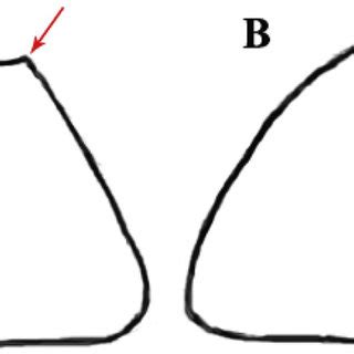 Illustration of two carapace (upper shell) cross-sections. A: The ...