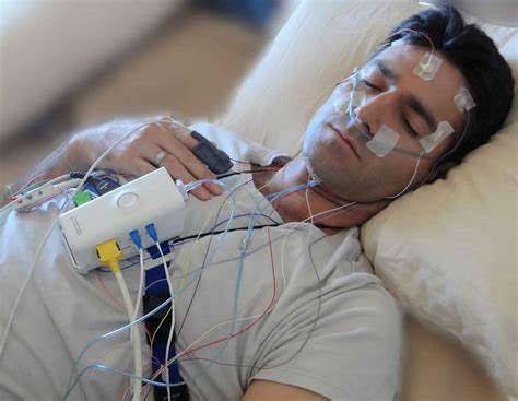 Polysomnography Sleep Study Indications Procedure And Test Results