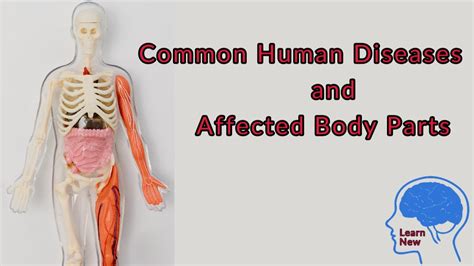 Diseases And Affected Body Parts Gk In English Common Human