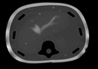 Triple Modality 3D Abdominal Phantom CIRS