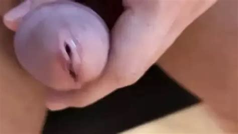 Swithch From 10 3mm Dilator To A 12mm Dialtor Gay Porn B8 XHamster