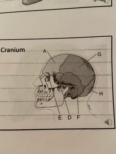 Cranium Radiologic Anatomy Flashcards Quizlet