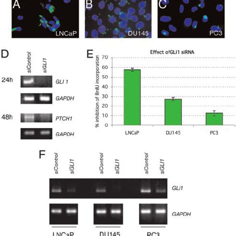 Expression Of SHH GLI Pathway Components In Normal Prostate Tissue