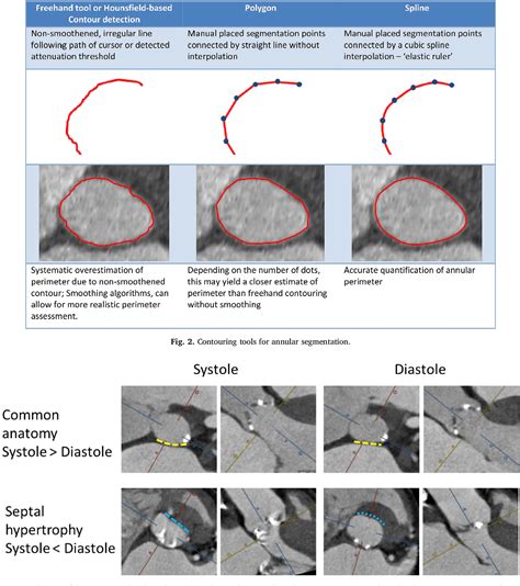 Table 1 From Computed Tomography Imaging In The Context Of