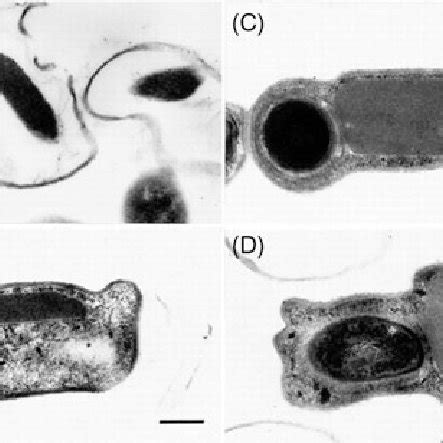 Transmission Electron Micrographs Of Wild Type And Recombinant