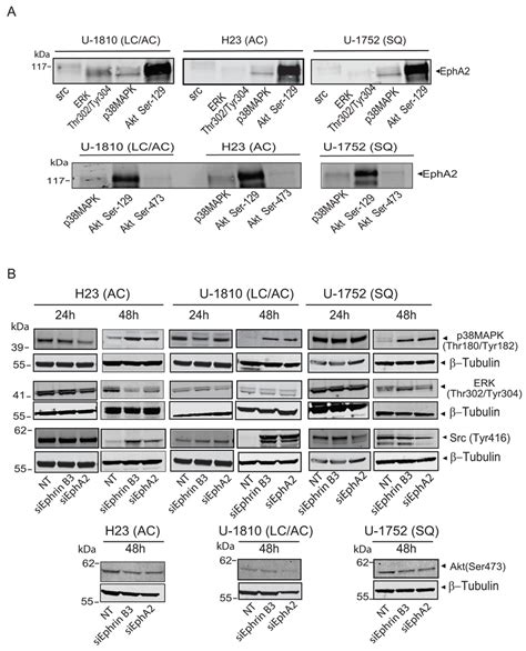 Ephrin B3 And EphA2 Interact And Control Multiple Proliferative