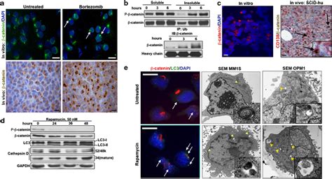 The Proteasome Aggresome Phagosome System Modulates β Catenin Download Scientific Diagram