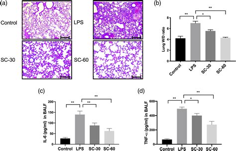 Sophocarpine Attenuates Lps Induced Acute Lung Injury Through Pulmonary