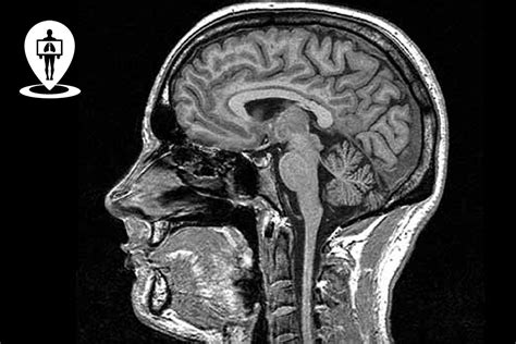 Risonanza Magnetica Encefalo A Cosa Serve Radiologia Italia