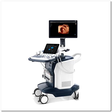 Sonoscape S60 Ultrasound Machine Revolutionizing Medical Imaging