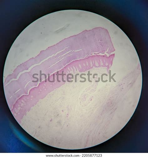 Photo Human Skin Tissue Under Microscope Stock Photo 2205877123 ...