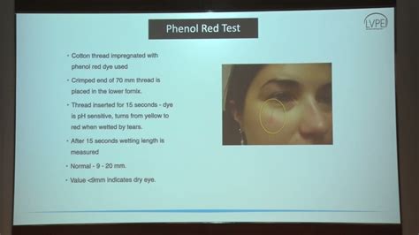 AIOC2022 GP102 Topic Dr Rashmi Deshmukh Evaluation Of A Patient With