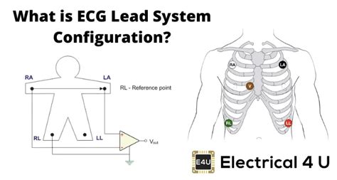 Ecg Lead System Configuration Electrical4u