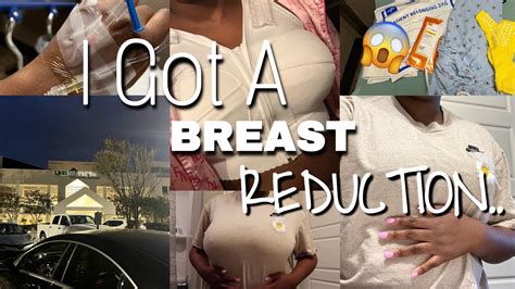 Vlog Breast Reduction Lift Dd To C Cup Youtube