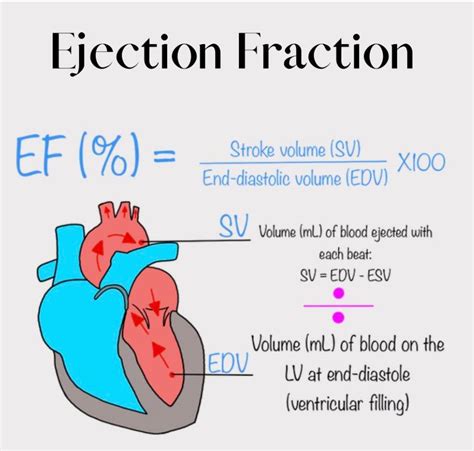 Ejection Fraction Medizzy