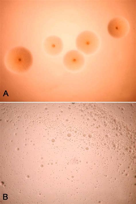 Mycoplasma Pneumoniae Fried Egg Appearance