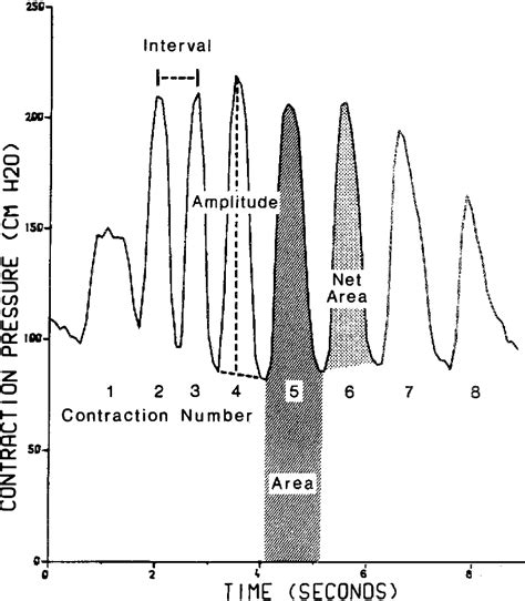 The Male Orgasm Pelvic Contractions Measured By Anal Probe Semantic