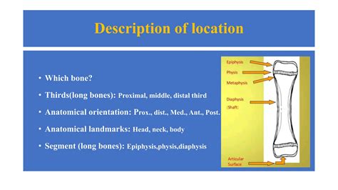 Fractures And Dislocations General Overview Pptx Free Download