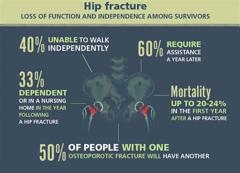 Hip Fracture Symptoms