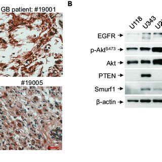 Pdf Smurf Silencing Restores Pten Expression That Ameliorates