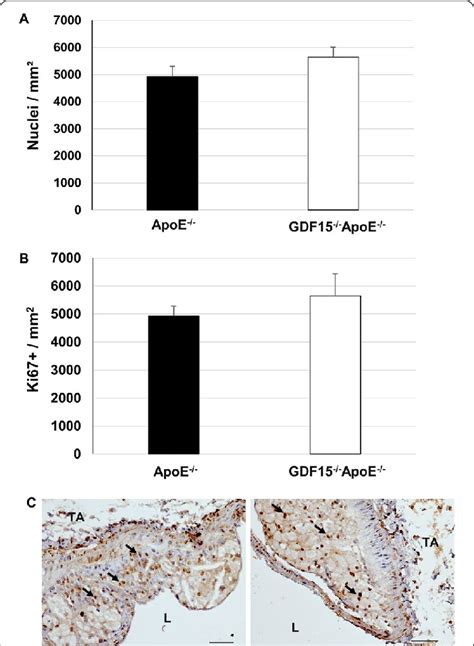 Effect Of GDF 15 Deficiency On The Morphology Cell Number