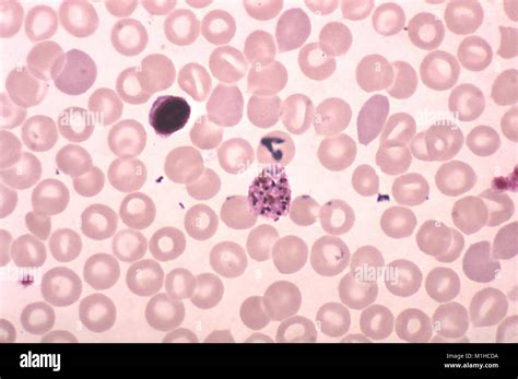 20 Merozoites Of Plasmodium Vivax Schizont Revealed In Thick Micrograph Film Using Giemsa Stain