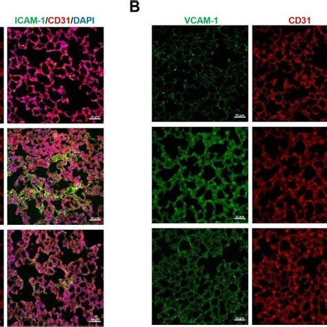 Cu06 1004 Downregulated Expression Of Adhesion Molecules In Lps Induced