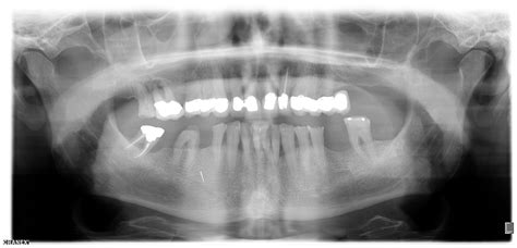 Describe The Uses Of Dental Imaging Chapter Garrett Has Rocha