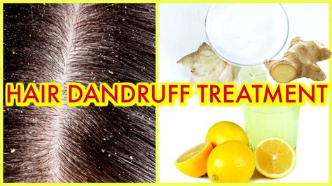 Dandruff Treatment With Lemon