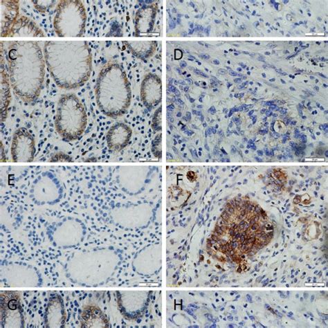 Immunohistochemical Demonstration Of Claudins Protein And E Cadherin