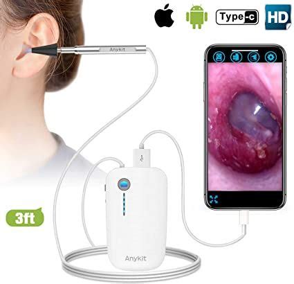 Amazon Otoscope Iphone Anykit Upgraded Mm P Hd Ear Scope