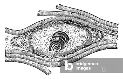 Trichinella Spiralis Anatomy