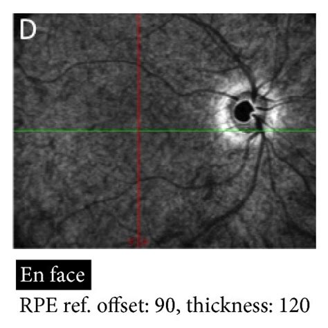 OCT images of normal eye. (a)–(d) En face OCT images at different ...