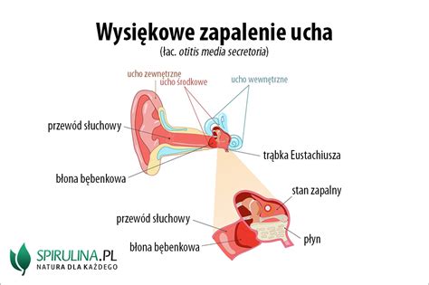 Wysiękowe zapalenie ucha środkowego algi Spirulina i Chlorella