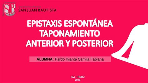 EPISTAXIS Camila Pardo UDocz