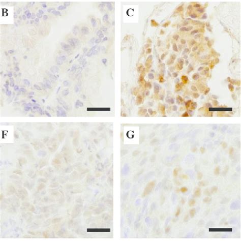 Representative Immunohistochemical Staining Of A D Cyclooxygenase