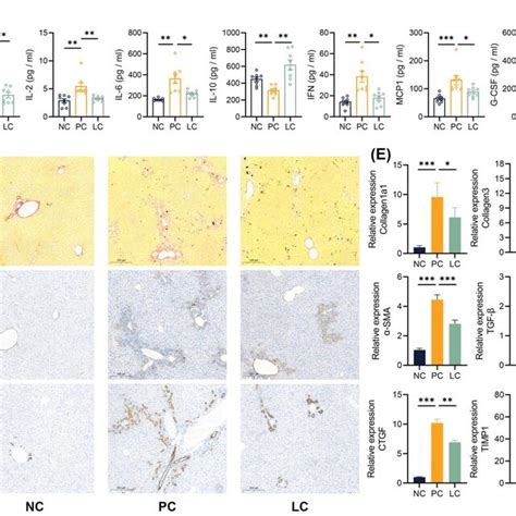 Li05 Attenuates Systemic Inflammation Liver Fibrosis And Bile Duct