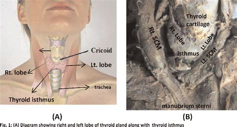 Isthmus Of Thyroid