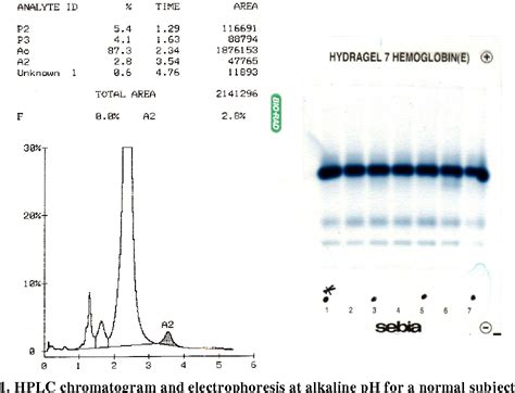 Figure 3 From Comparison Of Two Analytical Methods Electrophoresis And