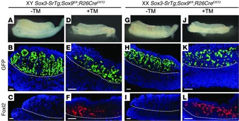 JCI Identification Of SOX3 As An XX Male Sex Reversal Gene In Mice And Humans