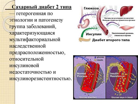 Сахарный диабет II типа. Инсулинорезистентность - презентация онлайн