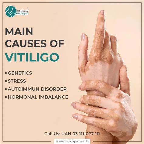 Vitiligo Treatment Institute Cosmetique Skin Specialist In Lahore