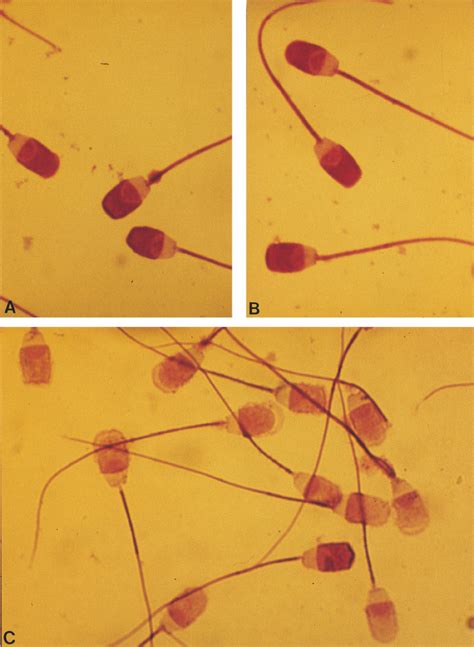 Light Micrographs Of Giemsa Stained Boar Spermatozoa Exposed To Cell Download Scientific