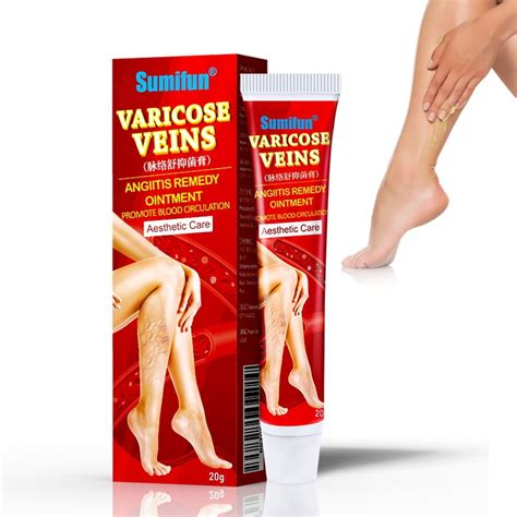 Varicose Veins Cream Varicose Vein Cooling Cream Eliminate Spider Veins And Reduce Swelling