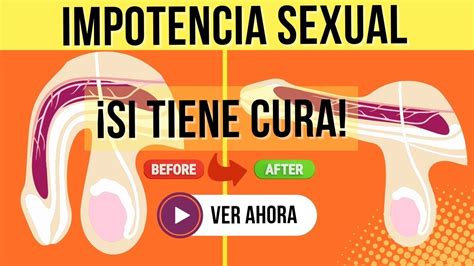 La Impotencia Sexual Consejos Que Funcionan Para Curarla Youtube